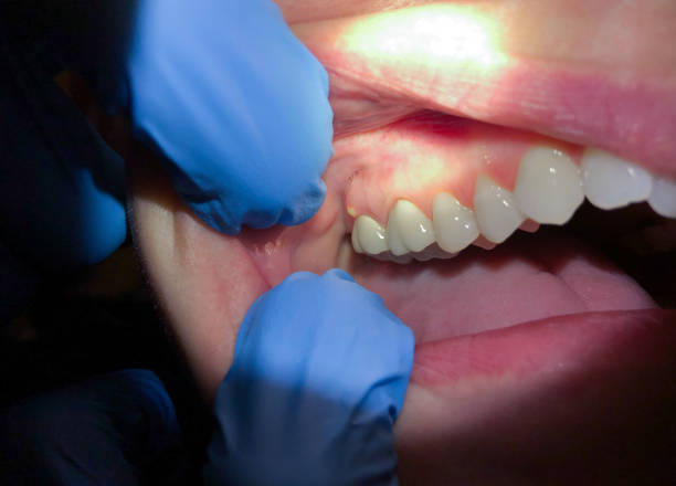 Best Cosmetic Emergency Dentistry in Philadelphia, PA